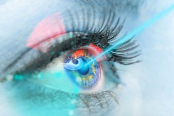 the course of laser vision correction procedure 